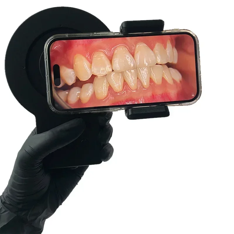 フルメディカルMK023歯科写真撮影機器口腔用携帯電話リング - Photography Lighting For Sale のレビューと価格